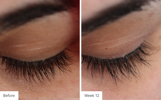 Close-up image of eyelashes showing fuller and longer lashes after 12 weeks of Lash Lush use